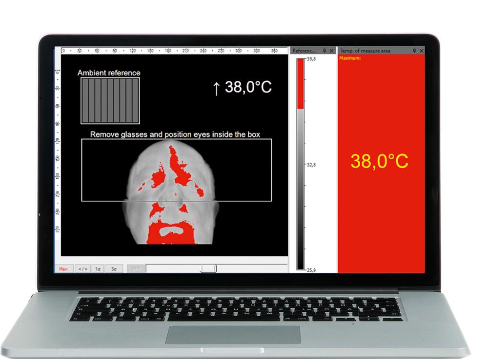 Enhanced Fever Screening Accuracy with Infrared Reference Source and additional Calibration Points